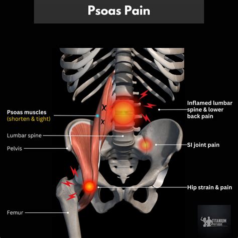 Lower Back Pain | Root Causes and Relief Exercises