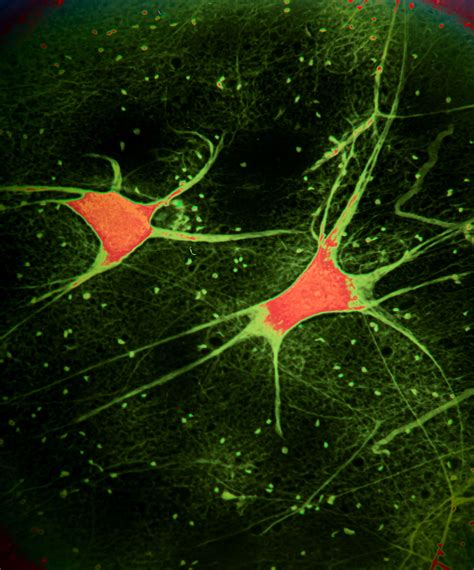 Neurons Under Microscope