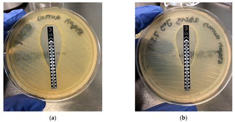 Toxic Effect of Vancomycin on Viability and Functionality of Different ...