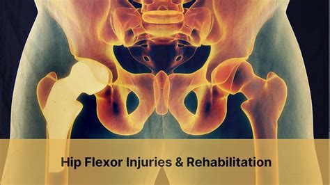 Hip Flexor Injuries & Rehabilitation | PhysioChoice