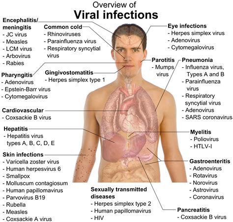 Viral infections | Medical knowledge, Nursing tips, Medical education