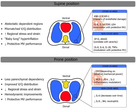JCM | Free Full-Text | Prone Positioning and Molecular Biomarkers in ...
