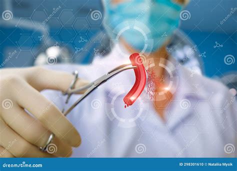 Concept of Surgical Treatment of Vascular Disease Stock Photo - Image of care, surface: 298301610 - treat venous disease