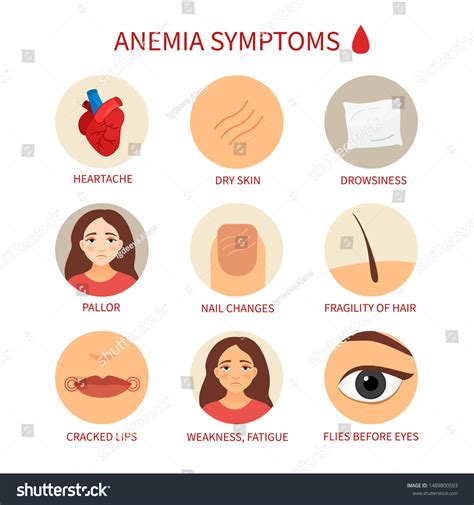 Anemia Eyes