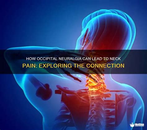 How Occipital Neuralgia Can Lead To Neck Pain: Exploring The Connection ...