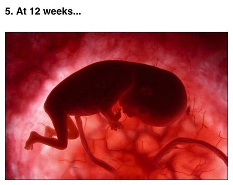 产检发现胎儿发育迟缓，怎么办？