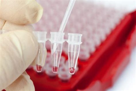 Image result for Cell Sorting Well Structure