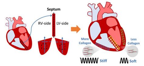 The Interventricular Septum Is Biomechanically Distinct from the ...
