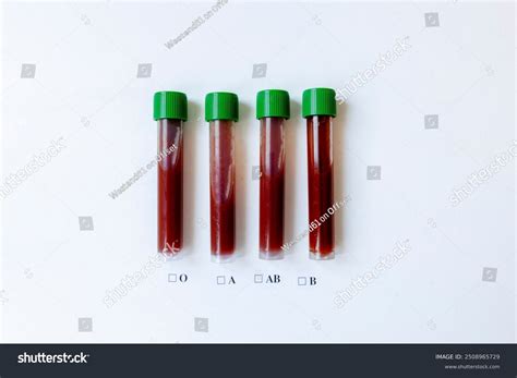 Four Blood Test Vials Green Caps Stock Photo 2508965729 | Shutterstock