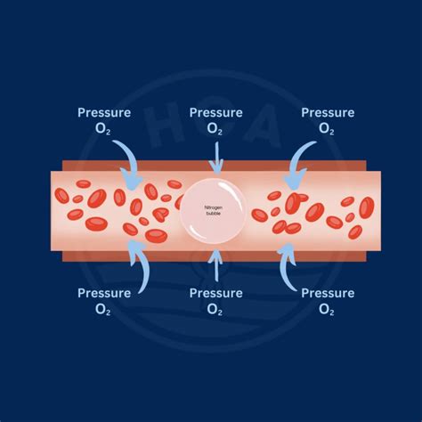 Healing Chambers of Asia – The Best Hyperbaric Oxygen Therapy Experience