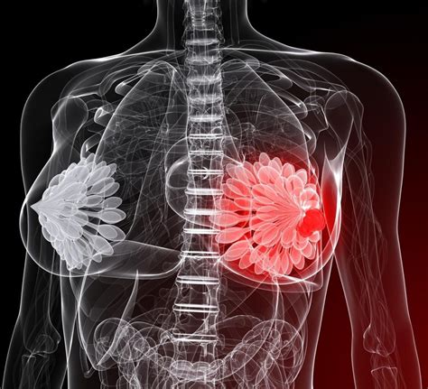 The Alarming Link between Parasites and Cancer - Youngevity Australia ...