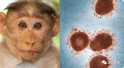胳膊上的“花”是预防天花的吗？猴痘、牛痘、天花、水痘有何区别？|猴痘|水痘|天花_新浪新闻