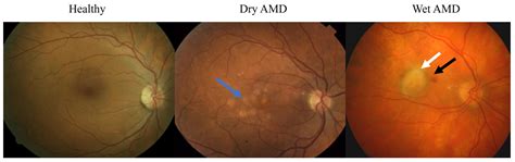 Non-Coding RNAs Regulating Mitochondrial Functions and the Oxidative ...