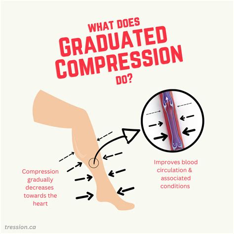 When to Use Compression 的图像结果
