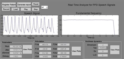 Image result for MATLAB User Interface