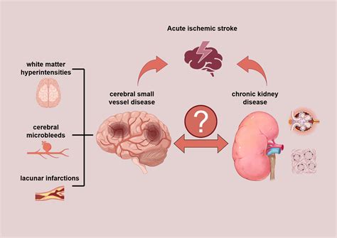 Associations of Cerebral Small Vessel Disease and Chronic Kidney Disease in Patients With Acute ...