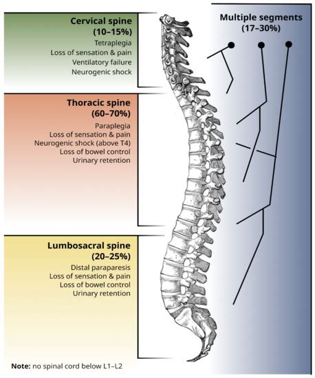 Spinal Cord Compression 的图像结果