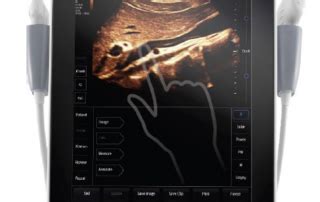 Image result for Mindray Te7 Measurements Tutorial