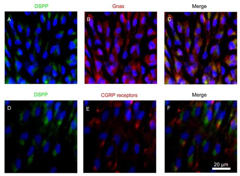 Gαs-Coupled CGRP Receptor Signaling Axis from the Trigeminal Ganglion ...