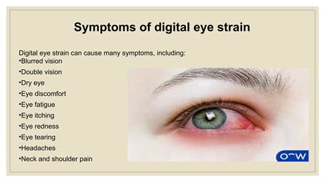 Image result for Physical Hazards in Using Computer