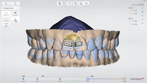 3Shape Design Studio 的图像结果