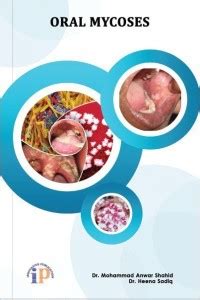 Oral Mycoses: Buy Oral Mycoses by Dr. Heena Sadiq, Dr. Mohammad Anwar ...