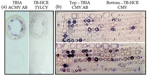 Development of a Novel Tissue Blot Hybridization Chain Reaction for the ...
