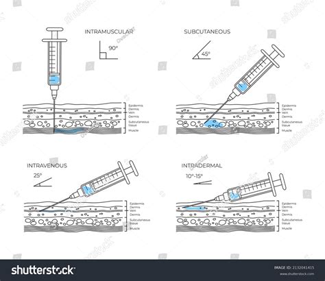 Image result for All Types of Injection