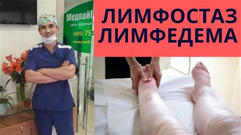 Лимфостаз - причины, симптомы, диагностика, лечение