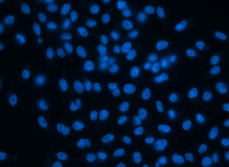 Codility Non-Overlapping Segments Python 的图像结果