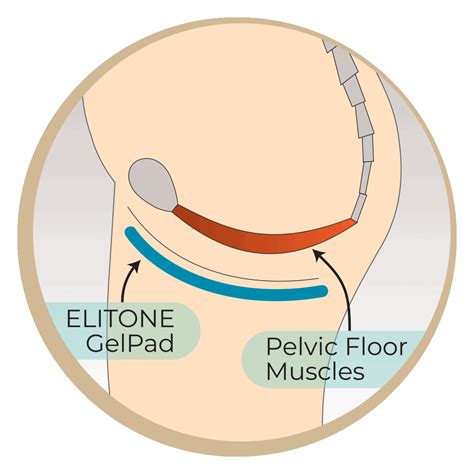 Do Tens Machine Work For Pelvic Floor Exercises | Viewfloor.co