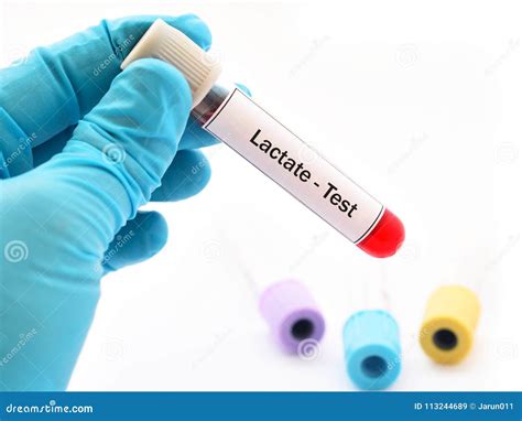 What Is Lactic Acid In Blood Test at Bruce Moreno blog
