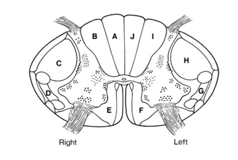 Image result for Contralateral Side