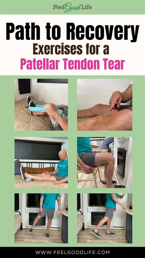 Image result for Patellar Dislocation Exercises