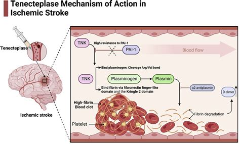 Optimizing Acute Ischemic Stroke Outcomes: The Role of Tenecteplase Before Mechanical ...