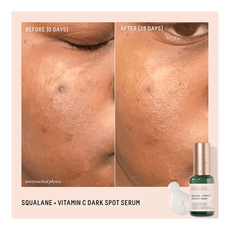 Squalane + Vitamin C Dark Spot Serum • 30ml