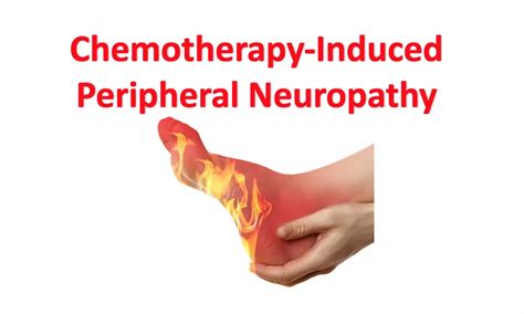 Managing Chemotherapy-Induced Peripheral Neuropathy in Adult Cancers ...