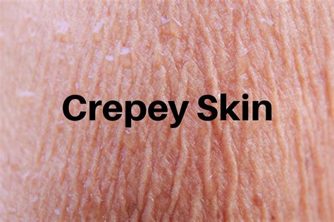 Crepey Skin: Common Causes and How to Tackle It | Sokörpe Laboratories ...