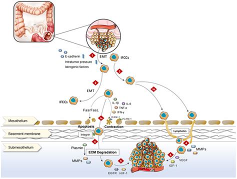 Peritoneal Metastasis: A Dilemma and Challenge in the Treatment of ...