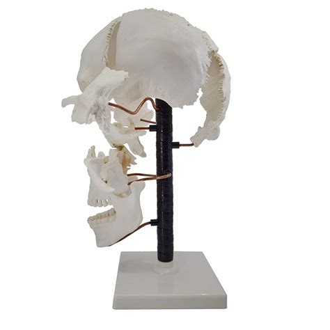 Image result for Exploded Skull