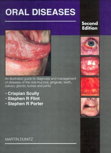 Buy Oral Diseases: An Illustrated Guide to Diagnosis and Management of ...