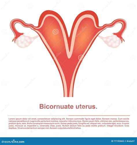 Bicornuate Cartoons, Illustrations & Vector Stock Images - 31 Pictures ...