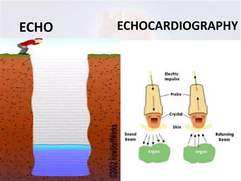 Image result for Cardiac Output Measurement