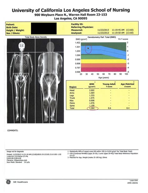Dexa Scan Vs Bioimpedance at Rachel Stearn blog