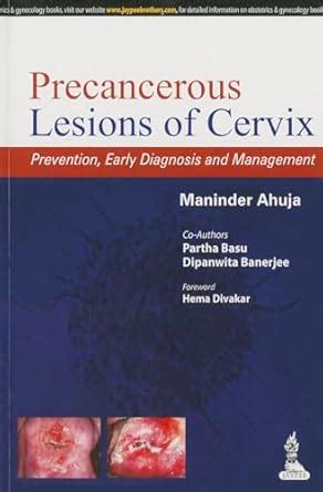 Buy PRECANCEROUS LESIONS OF CERVIX PREVENTION,EARLY DIAGNOSIS AND ...