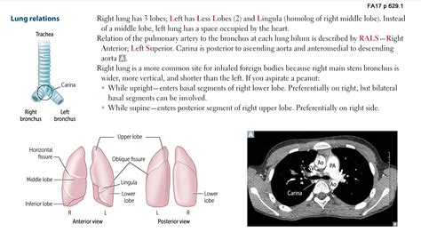 Lung Lingula Artery