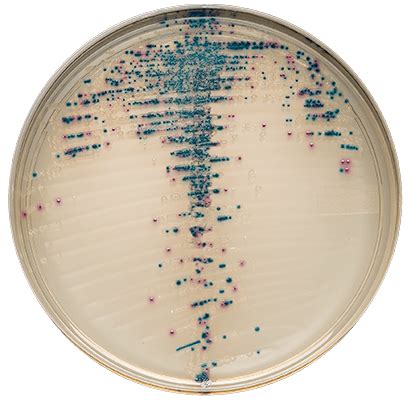 BD BBL™ Media | Ready-to-Use Plated Media for Isolation | BD