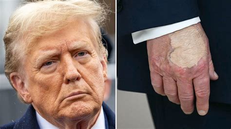 Donald Trump's Hand Makeup and Death Speculation | Know Your Meme