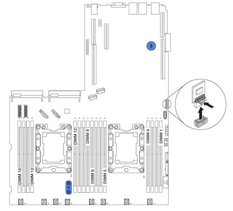 Image result for TCM Replacement