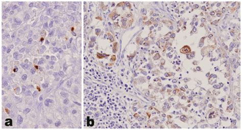 Differential Expression Profiles of Cell-to-Matrix-Related Molecules in ...